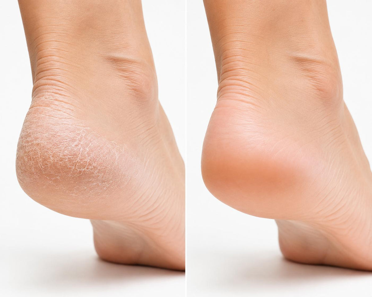 SilkyFeetPro